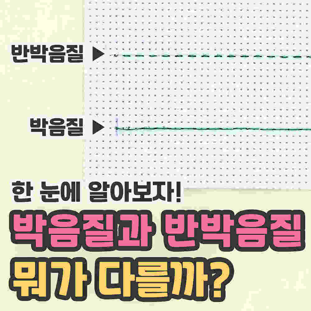 한 눈에 알아보자! 박음질과 반박음질 뭐가 다를까?